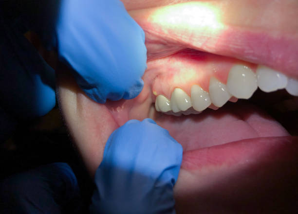 Best Chipped Tooth Repair Near Me  in Conway, PA